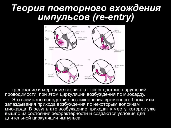 Теория повторного вхождения импульсов (re-entry) трепетание и мерцание возникают как следствие