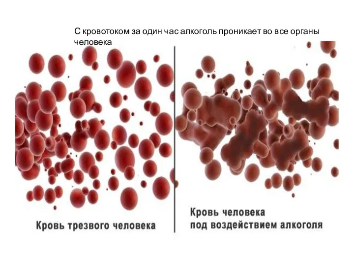 С кровотоком за один час алкоголь проникает во все органы человека