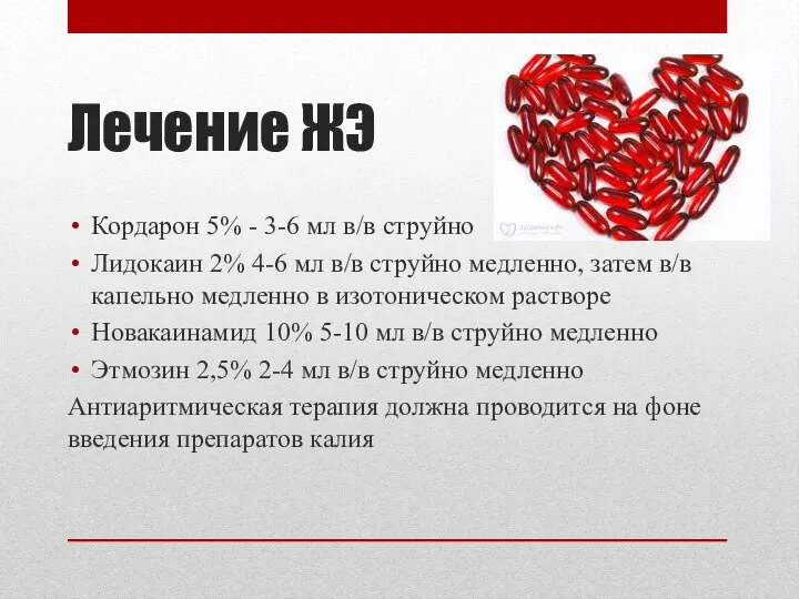 Лечение ЖЭ Кордарон 5% - 3-6 мл в/в струйно Лидокаин 2%