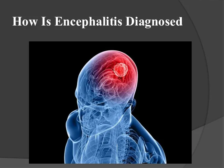 How Is Encephalitis Diagnosed