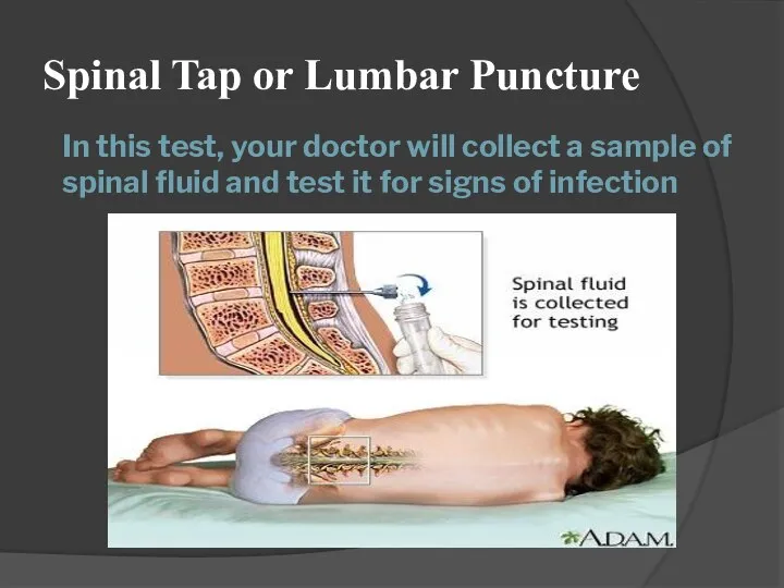 In this test, your doctor will collect a sample of spinal