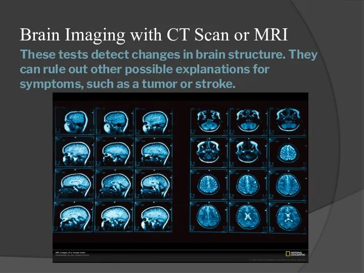 These tests detect changes in brain structure. They can rule out