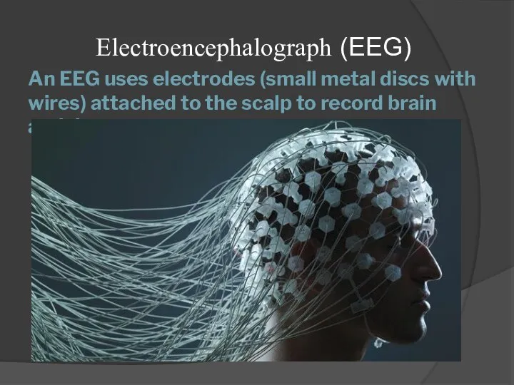 An EEG uses electrodes (small metal discs with wires) attached to