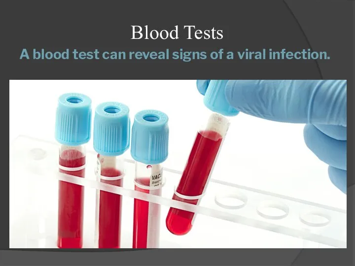 A blood test can reveal signs of a viral infection. Blood Tests