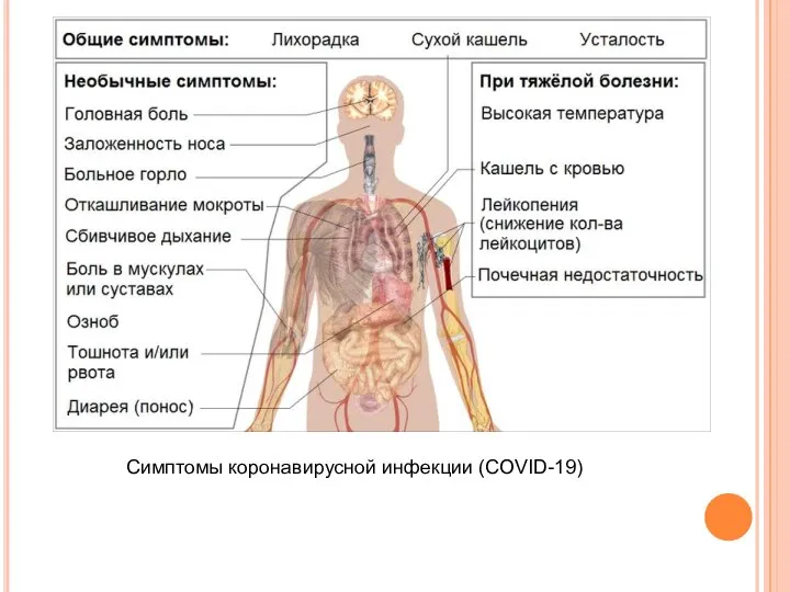 Симптомы коронавирусной инфекции (COVID-19)