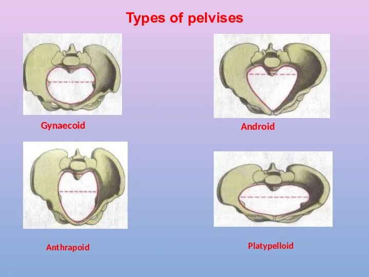 Types of pelvises Gynaecoid Anthrapoid Android Platypelloid