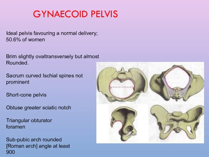 GYNAECOID PELVIS Ideal pelvis favouring a normal delivery; 50.6% of women