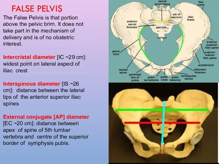 The False Pelvis is that portion above the pelvic brim. It