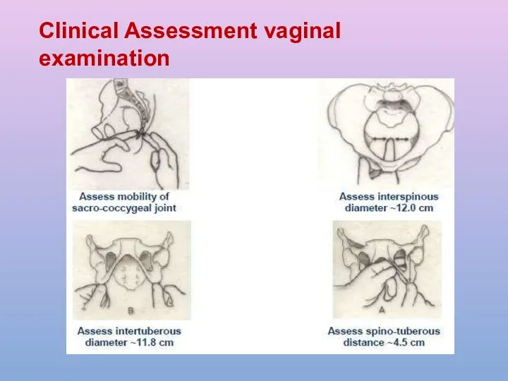 Clinical Assessment vaginal examination