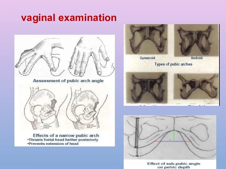 vaginal examination