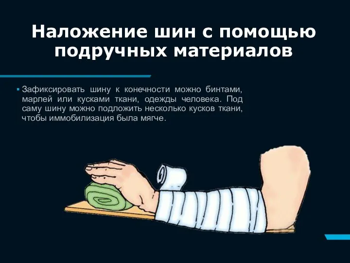 Зафиксировать шину к конечности можно бинтами, марлей или кусками ткани, одежды