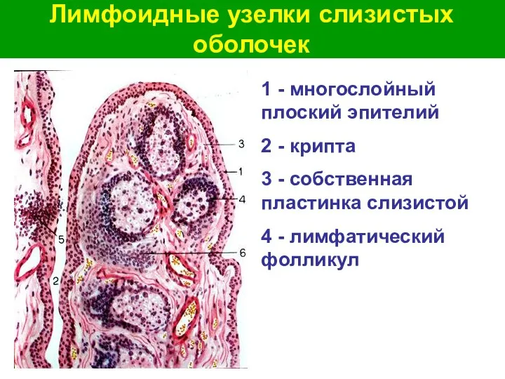 Лимфоидные узелки слизистых оболочек 1 - многослойный плоский эпителий 2 -