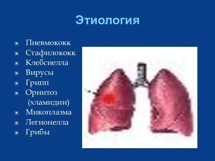 Этиология Пневмококк Стафилококк Клебсиелла Вирусы Грипп Орнитоз (хламидии) Микоплазма Легионелла Грибы