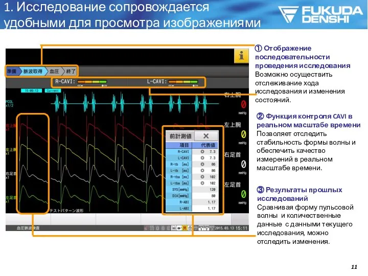 1. Исследование сопровождается удобными для просмотра изображениями ① Отображение последовательности проведения