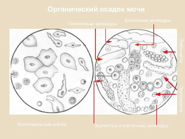 Органический осадок мочи Эпителиальные клетки Гиалиновые цилиндры Зернистые и клеточные цилиндры Эритроциты Лейкоциты Клеточные цилиндры