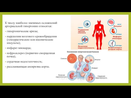 К числу наиболее значимых осложнений артериальной гипертонии относятся: гипертонические кризы; нарушения