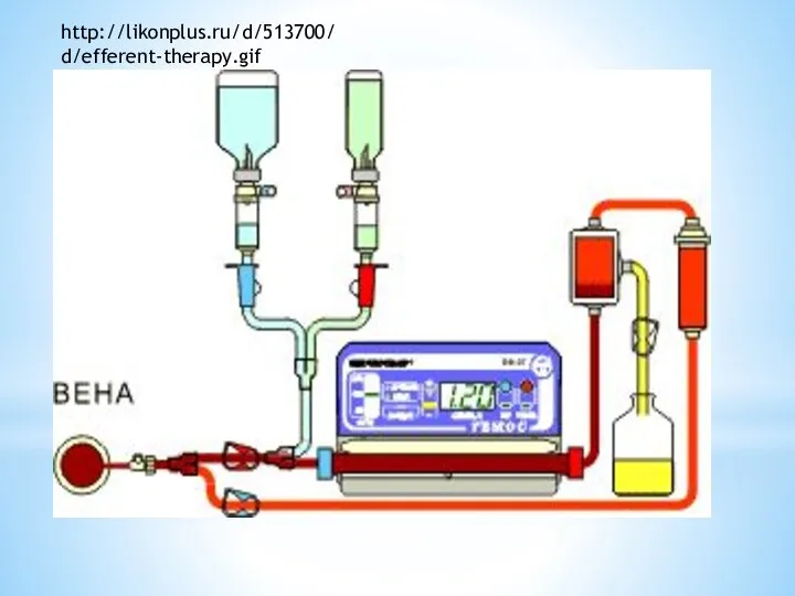 http://likonplus.ru/d/513700/d/efferent-therapy.gif