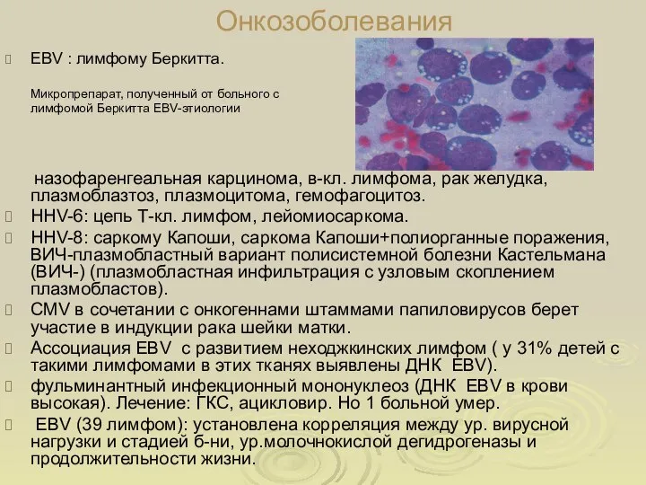 Онкозоболевания EBV : лимфому Беркитта. Микропрепарат, полученный от больного с лимфомой