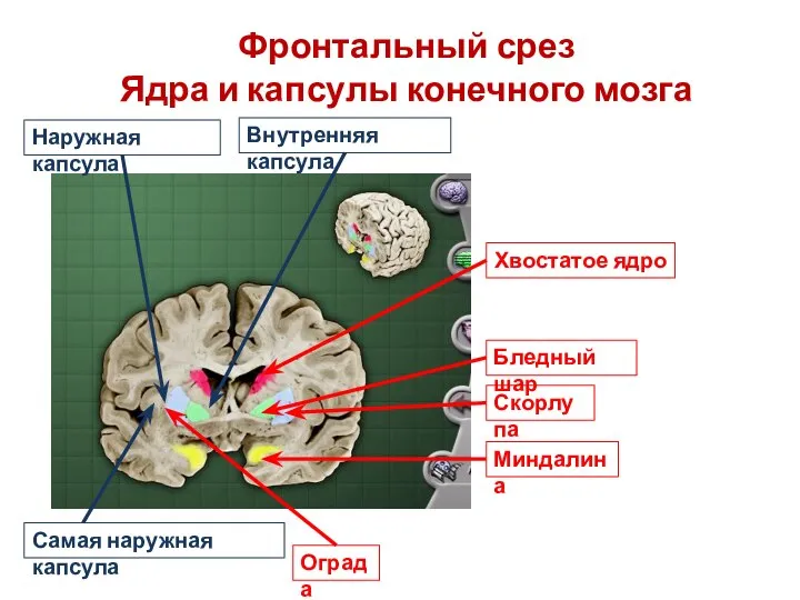 Фронтальный срез Ядра и капсулы конечного мозга Хвостатое ядро Бледный шар