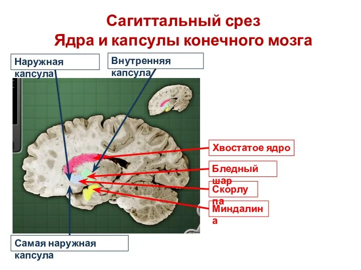 Хвостатое ядро Сагиттальный срез Ядра и капсулы конечного мозга Бледный шар