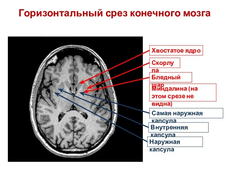 Хвостатое ядро Бледный шар Скорлупа Миндалина (на этом срезе не видна)