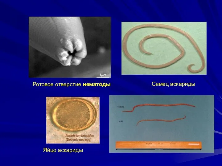 Ротовое отверстие нематоды Самец аскариды Яйцо аскариды