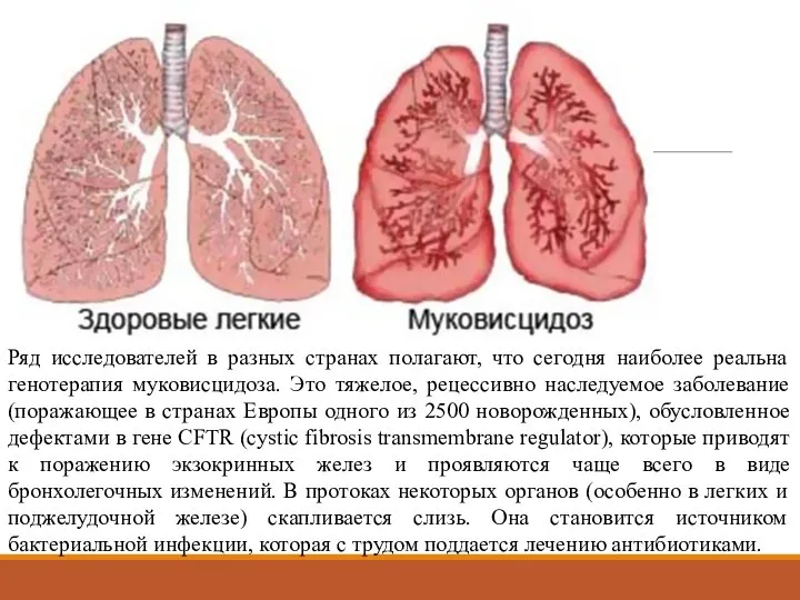 Ряд исследователей в разных странах полагают, что сегодня наиболее реальна генотерапия