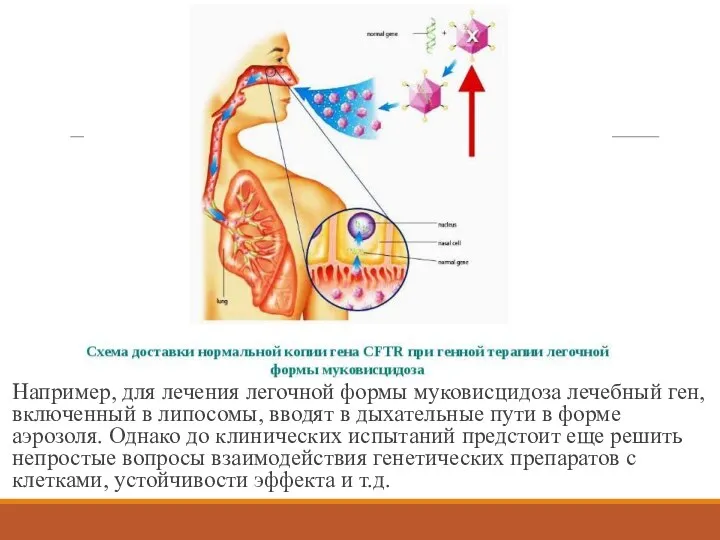 Например, для лечения легочной формы муковисцидоза лечебный ген, включенный в липосомы,