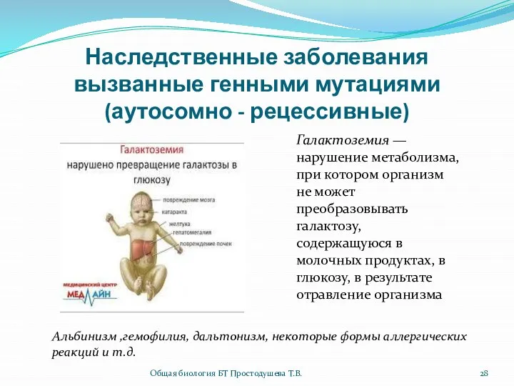 Наследственные заболевания вызванные генными мутациями (аутосомно - рецессивные) Галактоземия — нарушение