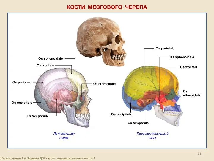 КОСТИ МОЗГОВОГО ЧЕРЕПА Латеральная норма Парасагиттальный срез Os sphenoidale Os parietale