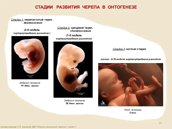 СТАДИИ РАЗВИТИЯ ЧЕРЕПА В ОНТОГЕНЕЗЕ Стадия 1: перепончатый череп, desmocranium Стадия