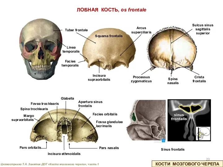 КОСТИ МОЗГОВОГО ЧЕРЕПА ЛОБНАЯ КОСТЬ, os frontale Squama frontalis Pars orbitalis