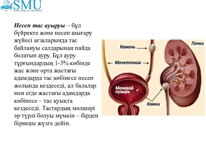 Несеп тас ауыруы – бұл бүйректе және несеп шығару жүйесі ағзаларында