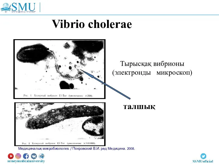 Vibrio cholerae талшық Тырысқақ вибрионы (электронды микроскоп) Медициналық микробиология. / Покровский В.И. ред Медицина. 2008.