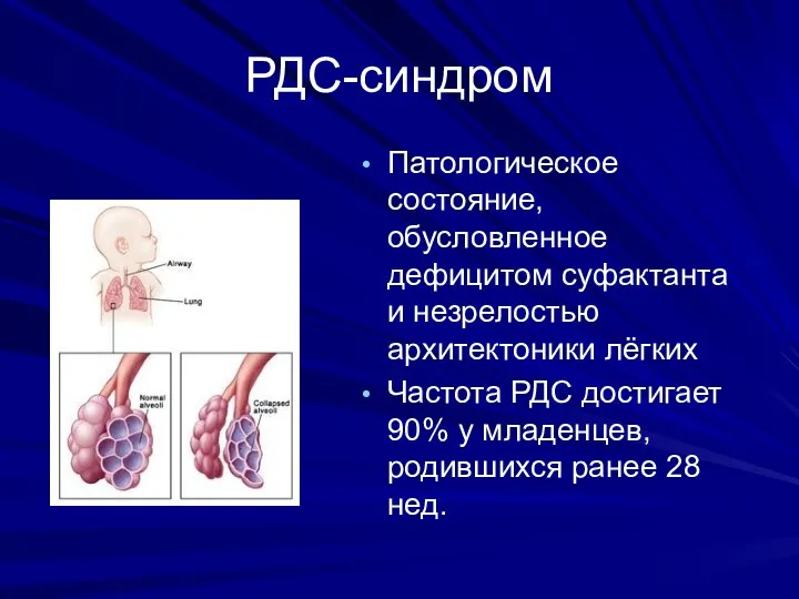 РДС-синдром Патологическое состояние, обусловленное дефицитом суфактанта и незрелостью архитектоники лёгких Частота