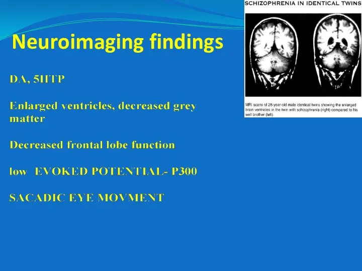 Neuroimaging findings