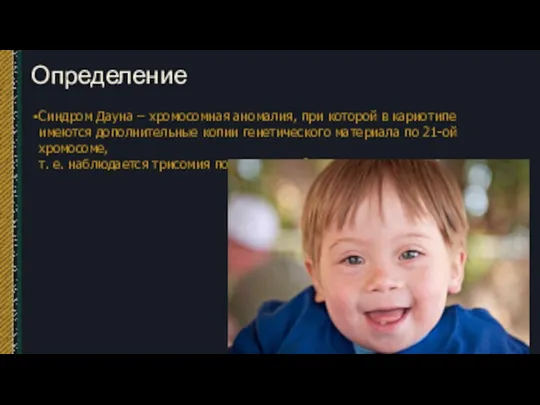 Определение Синдром Дауна – хромосомная аномалия, при которой в кариотипе имеются