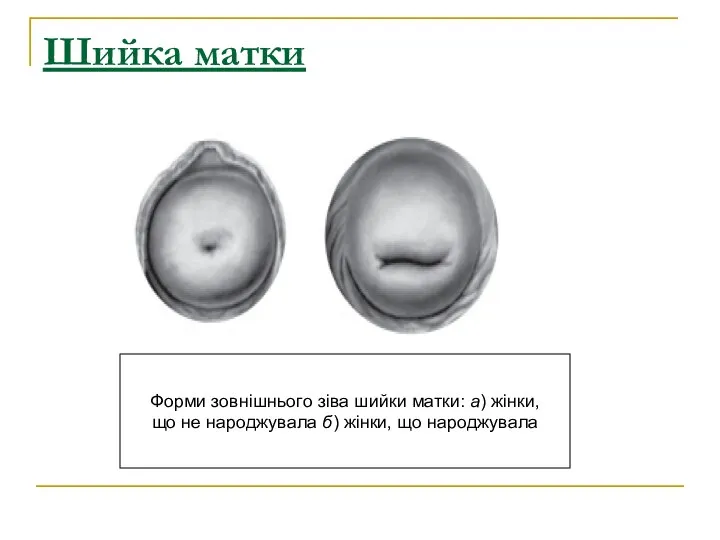 Шийка матки Форми зовнішнього зіва шийки матки: а) жінки, що не народжувала б) жінки, що народжувала