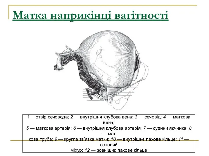 Матка наприкінці вагітності 1— отвір сечовода; 2 — внутрішня клубова вена;