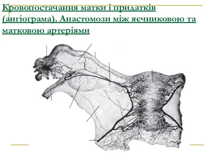 Кровопостачання матки і придатків (ангіограма). Анастомози між яєчниковою та матковою артеріями