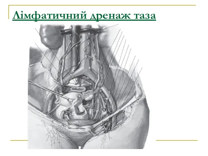 Лімфатичний дренаж таза