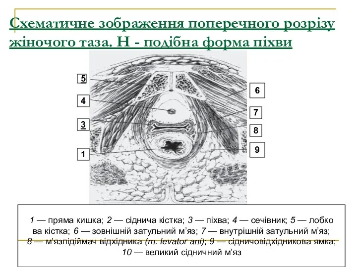 Схематичне зображення поперечного розрізу жіночого таза. Н - подібна форма піхви