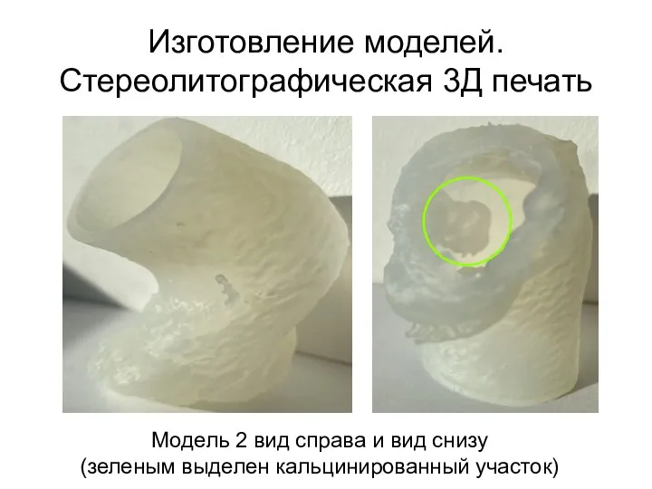 Изготовление моделей. Стереолитографическая 3Д печать Модель 2 вид справа и вид снизу (зеленым выделен кальцинированный участок)