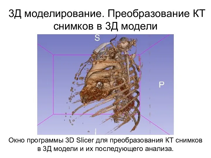 3Д моделирование. Преобразование КТ снимков в 3Д модели Окно программы 3D