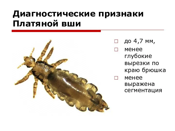 Диагностические признаки Платяной вши до 4,7 мм, менее глубокие вырезки по краю брюшка менее выражена сегментация