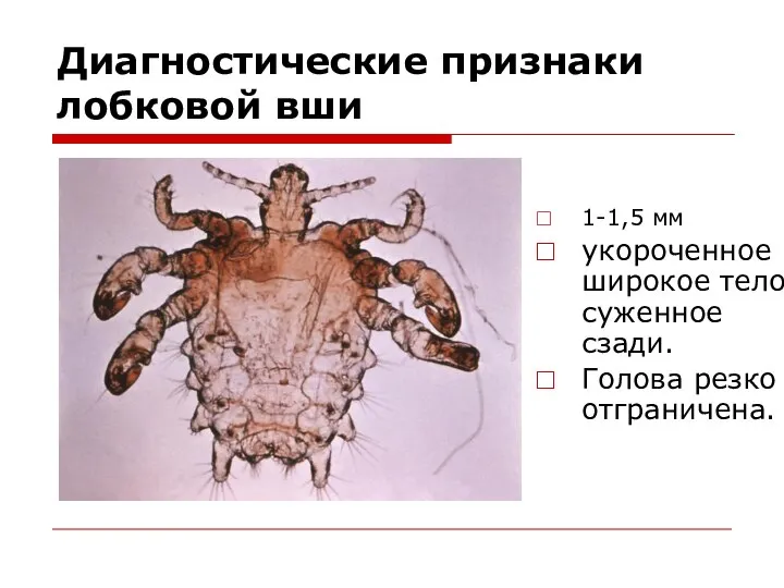 Диагностические признаки лобковой вши 1-1,5 мм укороченное широкое тело, суженное сзади. Голова резко отграничена.