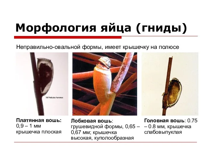 Морфология яйца (гниды) Неправильно-овальной формы, имеет крышечку на полюсе Платянная вошь: