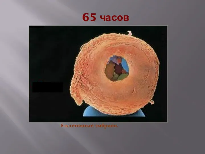 65 часов 8-клеточный эмбрион.