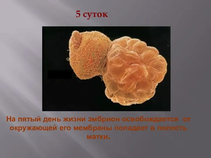 На пятый день жизни эмбрион освобождается от окружающей его мембраны попадает в полость матки. 5 суток