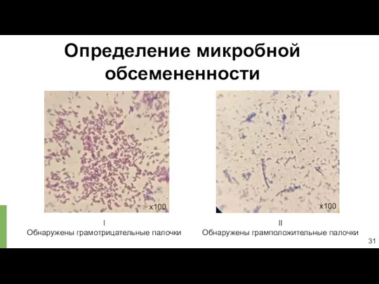 I Обнаружены грамотрицательные палочки Определение микробной обсемененности II Обнаружены грамположительные палочки 31 х100 х100